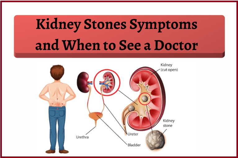 Symptoms of Kidney Stones